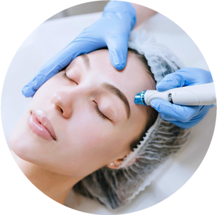 Microneedling Therapy